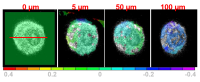 FEBio infinote element modeling of spinal disc cell deformation